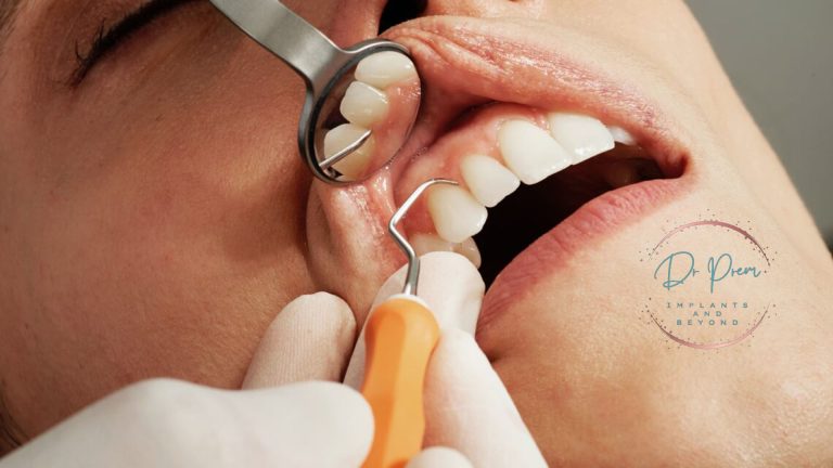 dental implants cost in india